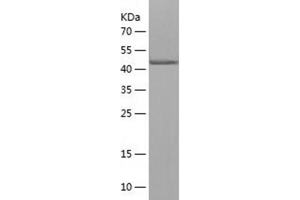 TUBA1A Protein (AA 214-413) (His-IF2DI Tag)