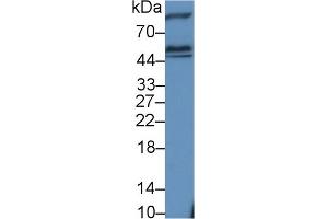 Detection of HEXa in Rat Cerebrum lysate using Polyclonal Antibody to Hexosaminidase A Alpha (HEXa) (Hexosaminidase A 抗体  (AA 318-529))