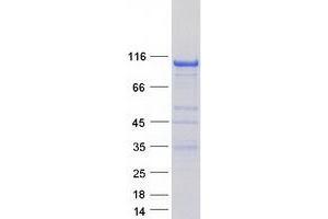 Western Blotting (WB) image for PTK2B Protein tyrosine Kinase 2 beta (PTK2B) (Transcript Variant 2) protein (Myc-DYKDDDDK Tag) (ABIN2720715)