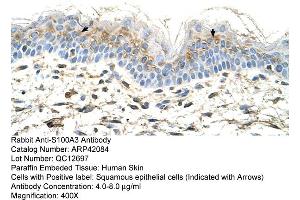 Rabbit Anti-S100A3 Antibody  Paraffin Embedded Tissue: Human Skin Cellular Data: Squamous epithelial cells Antibody Concentration: 4. (S100A3 抗体  (N-Term))