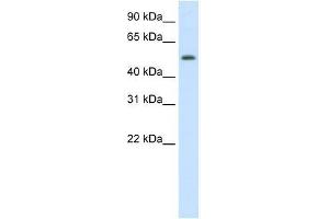 DIDO1 antibody used at 1. (DIDO1 抗体  (N-Term))