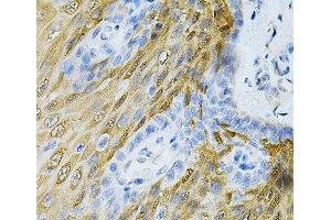 Immunohistochemistry of paraffin-embedded Human esophagus using HGF Polyclonal Antibody at dilution of 1:100 (40x lens). (HGF 抗体)