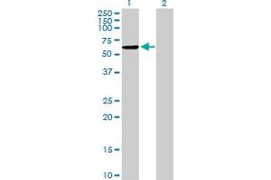 Western Blot analysis of NAP1L2 expression in transfected 293T cell line by NAP1L2 MaxPab polyclonal antibody. (NAP1L2 抗体  (AA 1-460))