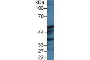 Western Blot; Sample: Rat Prostate lysate; Primary Ab: 2µg/ml Rabbit Anti-Human PTGIS Antibody Second Ab: 0. (PTGIS 抗体  (AA 1-500))
