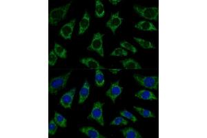 Immunofluorescence analysis of L929 cells using ETFB Polyclonal Antibody (ABIN7266916) at dilution of 1:100 (40x lens). (ETFB 抗体  (AA 80-230))