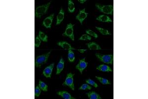Immunofluorescence analysis of L929 cells using ETFB Polyclonal Antibody (ABIN7266916) at dilution of 1:100 (40x lens). (ETFB 抗体  (AA 80-230))