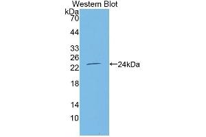Western Blotting (WB) image for anti-Tumor Necrosis Factor Receptor Superfamily, Member 11a, NFKB Activator (TNFRSF11A) (AA 31-214) antibody (ABIN3205541) (TNFRSF11A 抗体  (AA 31-214))