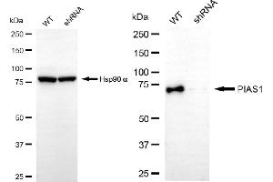 Western blotting analysis using PIAS1 antibody (ABIN7799978). (Recombinant PIAS1 抗体)