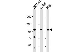 All lanes : Anti-REST Antibody (Center) at 1:2000 dilution Lane 1: 293T/17 whole cell lysate Lane 2: Jurkat whole cell lysate Lane 3: Raji whole cell lysate Lysates/proteins at 20 μg per lane. (REST 抗体  (AA 542-570))