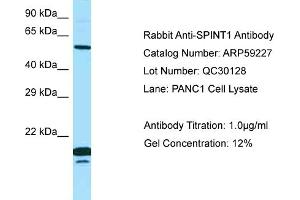 Western Blotting (WB) image for anti-serine Peptidase Inhibitor, Kunitz Type 1 (SPINT1) (N-Term) antibody (ABIN2787983)