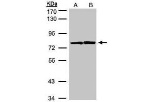 Western Blotting (WB) image for anti-Hydroxyacyl-Coenzyme A Dehydrogenase/3-Ketoacyl-Coenzyme A Thiolase/enoyl-Coenzyme A Hydratase (Trifunctional Protein), alpha Subunit (HADHA) (C-Term) antibody (ABIN2854961)