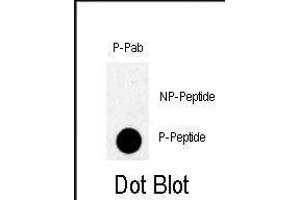 anti-TBK (pSer172) antibody