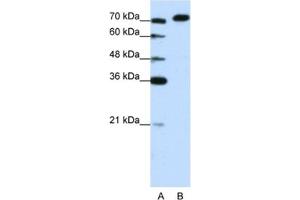 Western Blotting (WB) image for anti-A Kinase (PRKA) Anchor Protein 8-Like (AKAP8L) antibody (ABIN2461849) (AKAP8L 抗体)