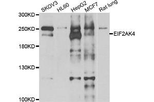 Western blot analysis of extracts of various cell lines, using EIF2AK4 antibody. (GCN2 抗体)