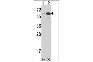 Image no. 2 for anti-Estrogen-Related Receptor gamma (ESRRG) (AA 198-227) antibody (ABIN360233) (ESRRG 抗体  (AA 198-227))