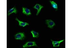 Immunofluorescence staining of A549 cells with ABIN7168513 at 1:100, counter-stained with DAPI. (RYR3 抗体  (AA 987-1147))