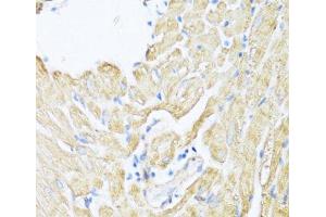 Immunohistochemistry of paraffin-embedded Rat heart using ALOX12 Polyclonal Antibody at dilution of 1:100 (40x lens). (ALOX12 抗体)