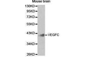 Western Blotting (WB) image for anti-Vascular Endothelial Growth Factor C (VEGFC) antibody (ABIN1875325) (VEGFC 抗体)