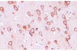 Immunohistochemistry of paraffin-embedded Rat brain using RPL21 Polyclonal Antibody at dilution of 1:100 (40x lens). (RPL21 抗体)