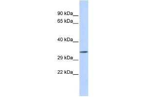 WB Suggested Anti-TEX264 Antibody Titration:  0. (TEX264 抗体  (Middle Region))