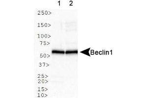 Image no. 6 for anti-Beclin 1, Autophagy Related (BECN1) antibody (ABIN363435)