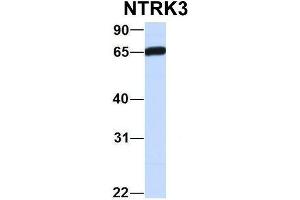 Western Blotting (WB) image for anti-Neurotrophic tyrosine Kinase, Receptor, Type 3 (NTRK3) (C-Term) antibody (ABIN2784511)