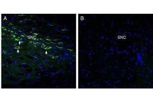 Expression of Oxytocyn Receptor in rat midbrain. (Oxytocin Receptor 抗体  (C-Term, Intracellular))