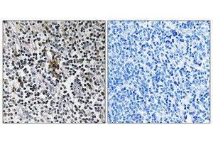 Immunohistochemistry (IHC) image for anti-Ribosomal Protein S3 (RPS3) (C-Term) antibody (ABIN1850588) (RPS3 抗体  (C-Term))