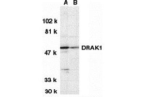 Western Blotting (WB) image for anti-serine/threonine Kinase 17a (STK17A) (N-Term) antibody (ABIN1031360) (STK17A 抗体  (N-Term))