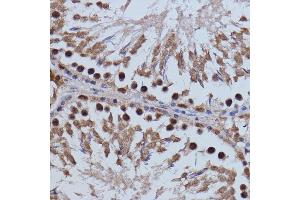 Immunohistochemistry of paraffin-embedded rat testis using BRD4 antibody (ABIN6127508, ABIN6137653, ABIN6137654 and ABIN7101457) at dilution of 1:100 (40x lens). (BRD4 抗体  (AA 1100-1200))