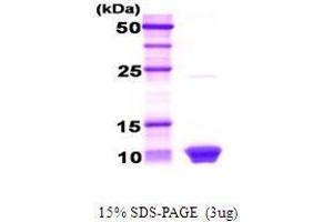 Figure annotation denotes ug of protein loaded and % gel used. (HSBP1 蛋白)