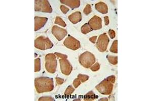 Formalin-fixed and paraffin-embedded human skeletal muscle reacted with ANGPTL4 Antibody (Center), which was peroxidase-conjugated to the secondary antibody, followed by DAB staining. (ANGPTL4 抗体  (Middle Region))