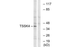 Western blot analysis of extracts from HT-29 cells, using TSSK4 antibody. (TSSK4 抗体  (Internal Region))