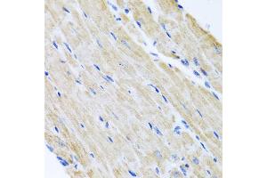 Immunohistochemistry of paraffin-embedded mouse heart using ABCB8 antibody (ABIN5974712) at dilution of 1/100 (40x lens). (ABCB8 抗体)