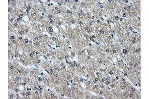 Immunohistochemical staining of paraffin-embedded liver tissue using anti-HDAC10mouse monoclonal antibody. (HDAC10 抗体)