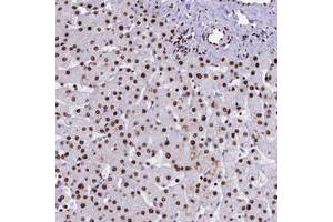 Immunohistochemical staining of human liver with SRRM2 polyclonal antibody  shows strong nuclear positivity in hepatocytes. (SRRM2 抗体)