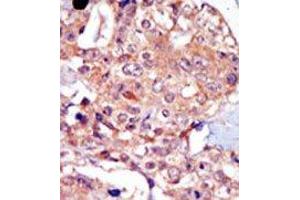 Image no. 2 for anti-Transient Receptor Potential Cation Channel, Subfamily M, Member 7 (TRPM7) (N-Term) antibody (ABIN360498)