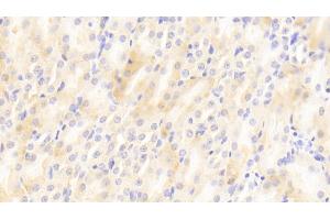 Detection of MIg in Mouse Kidney Tissue using Polyclonal Antibody to Monokine Induced By Interferon Gamma (MIg) (CXCL9 抗体  (AA 22-126))