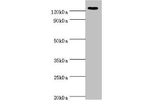 Western blot All lanes: NLRP2 antibody at 12 μg/mL + A431 whole cell lysate Secondary Goat polyclonal to rabbit IgG at 1/10000 dilution Predicted band size: 121, 119, 97, 118 kDa Observed band size: 121 kDa (NLRP2 抗体  (AA 1-220))