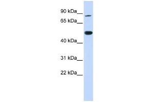 WB Suggested Anti-TRMT1 Antibody Titration:  0. (TRMT1 抗体  (N-Term))