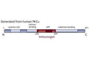 Image no. 3 for anti-Protein Kinase C, alpha (PKCa) (AA 270-427) antibody (ABIN967751) (PKC alpha 抗体  (AA 270-427))
