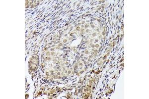 Immunohistochemistry of paraffin-embedded rat ovary using PSMD14 Rabbit mAb (ABIN7269588) at dilution of 1:100 (40x lens). (PSMD14 抗体)