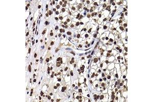 Immunohistochemistry (Paraffin-embedded Sections) (IHC (p)) image for anti-DnaJ (Hsp40) Homolog, Subfamily B, Member 6 (DNAJB6) (AA 177-326) antibody (ABIN6139713)
