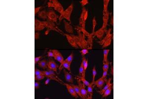 Immunofluorescence analysis of PC-12 cells using Proprotein Convertase 9(PCSK9) Rabbit pAb (ABIN6133851, ABIN6145328, ABIN6145330 and ABIN6223837) at dilution of 1:250 (40x lens). (PCSK9 抗体  (C-Term))