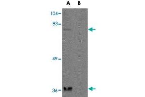 Western blot analysis of NAA35 in rat heart tissue lysate with NAA35 polyclonal antibody  at 1 ug/mL in the (A) absence and (B) presence of blocking peptide. (MAK10/NAA35 抗体  (N-Term))