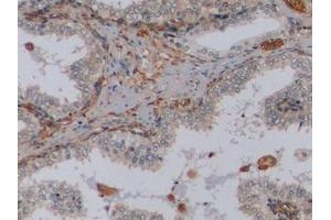 Immunohistochemistry (IHC) image for anti-Vimentin (VIM) antibody (ABIN7426163)