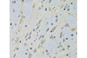 Immunohistochemistry of paraffin-embedded Mouse brain using DARS Polyclonal Antibody at dilution of 1:100 (40x lens). (DARS 抗体)