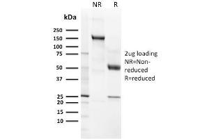 SDS-PAGE Analysis Purified CD21 / CR2 Recombinant Rabbit Monoclonal Antibody (CR2/3124R). (Recombinant CD21 抗体  (AA 142-240))
