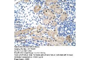 Rabbit Anti-RNASEH2A Antibody  Paraffin Embedded Tissue: Human Kidney Cellular Data: Epithelial cells of renal tubule Antibody Concentration: 4. (RNASEH2A 抗体  (Middle Region))