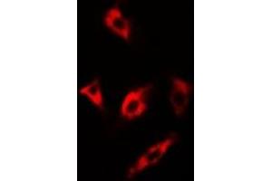 Immunofluorescent analysis of MsrA staining in U2OS cells. (MSRA 抗体)
